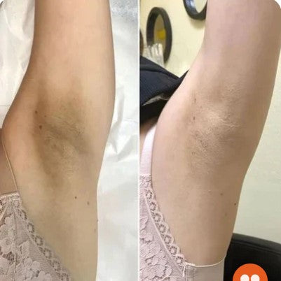 Melaxin Peel Shot Exfoliating